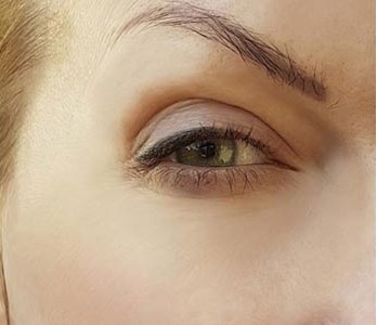 قبل از خدمات کلینیک لونا