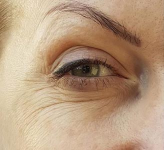 بعد از خدمات کلینیک لونا
